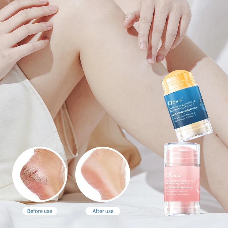 Anti Crack Foot Cream For Dry  - Heels recension och pris